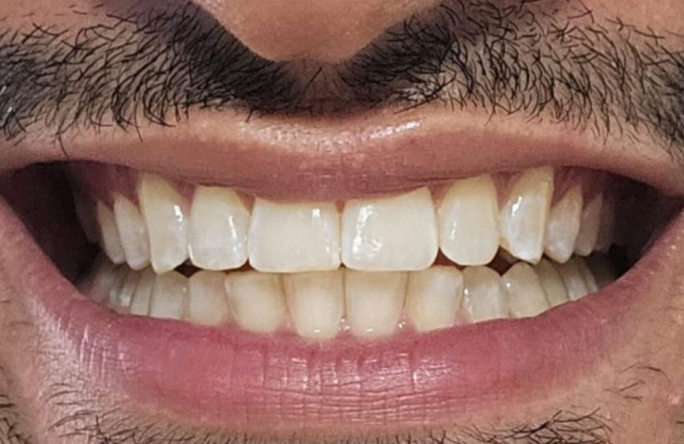 SORRISO POR DR HIAGO DANTAS